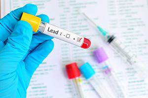 lab technician examines vial for blood lead test